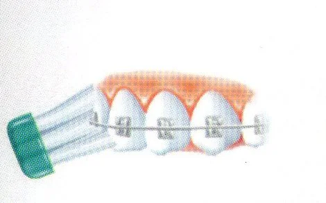 Como escovar os dentes