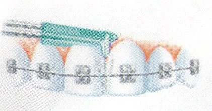 Como escovar os dentes
